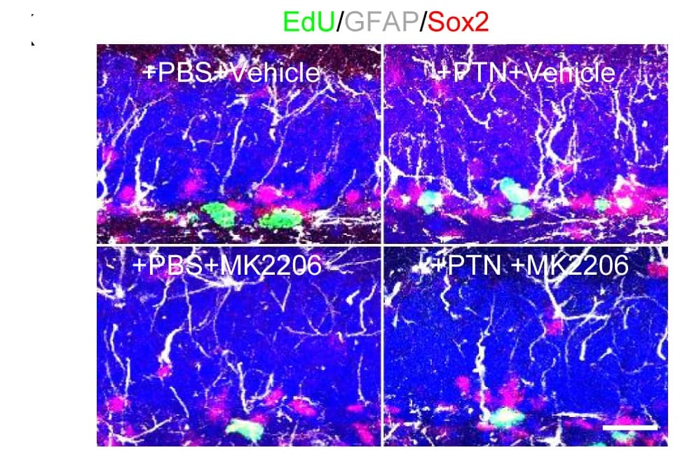 Open access visualization of Microscopy, EdU, GFAP, Sox2, Costaining