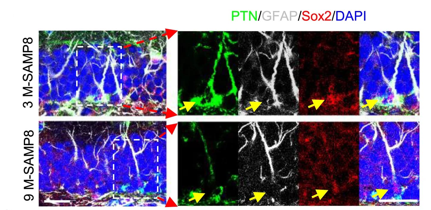 Open access visualization of Microscopy, Dentate Gyrus, PTN, GFAP, Sox2