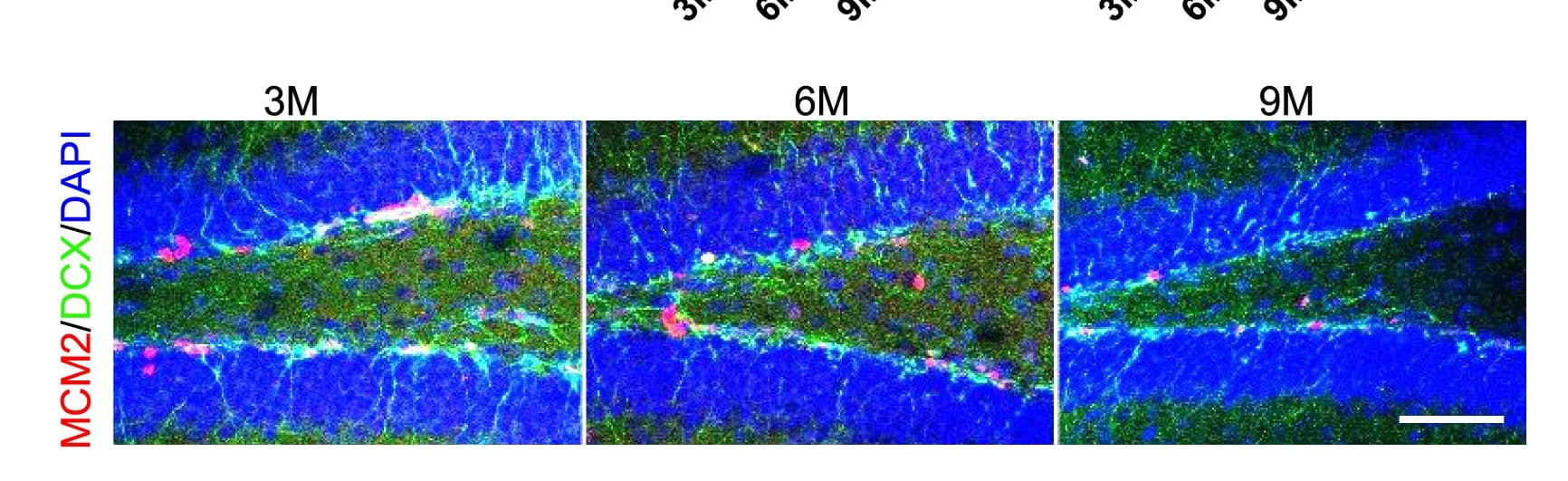Open access visualization of Microscopy, Immunofluorescence, MCM2, DCX, DAPI
