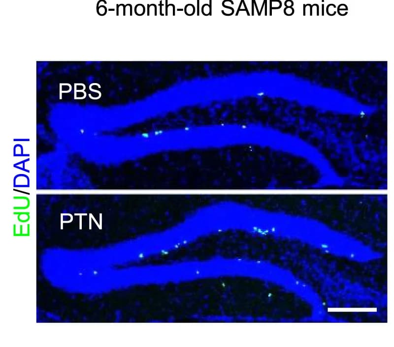 Open access visualization of Microscopy, Immunofluorescence, EdU, DAPI, Dentate Gyrus