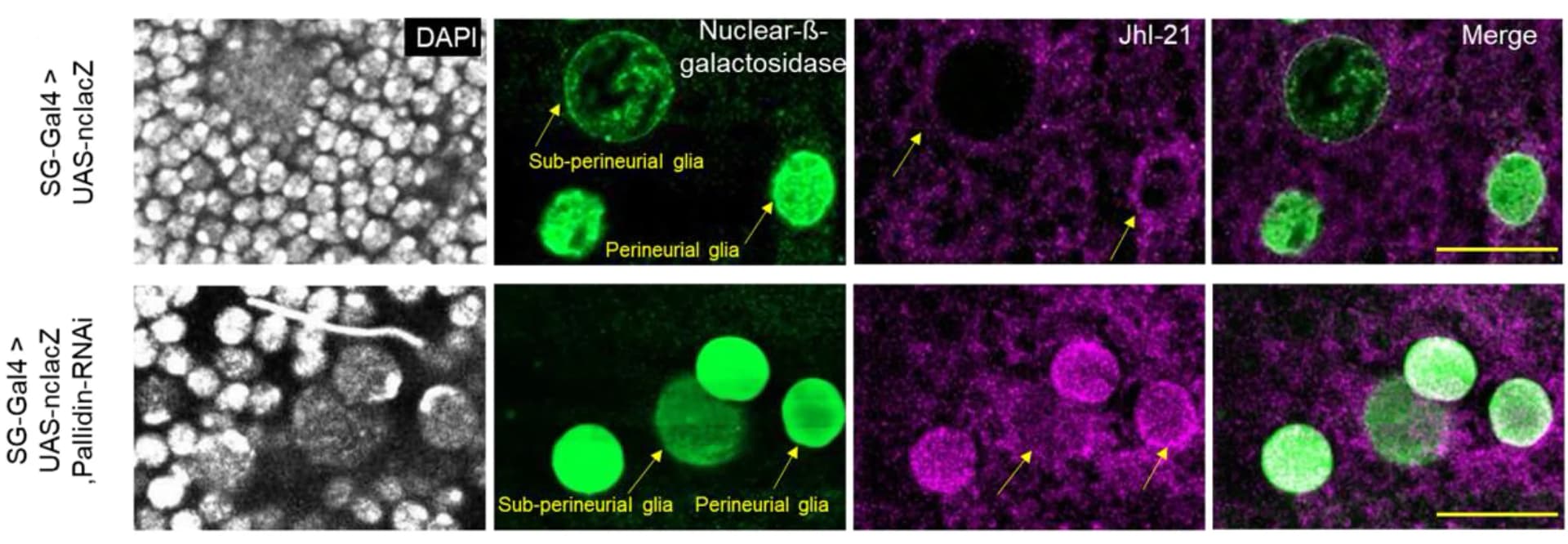Open access visualization of Microscopy, Brain, UAS-nuclear-LacZ, UAS-Pallidin-RNAi, Perineurial Cells