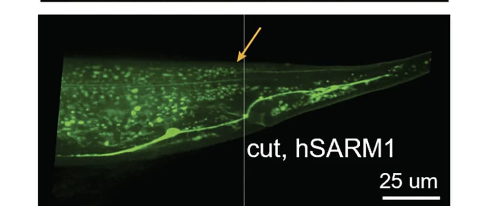 Open access visualization of Microscopy, Micrograph, hSARM, Degeneration, Axotomy