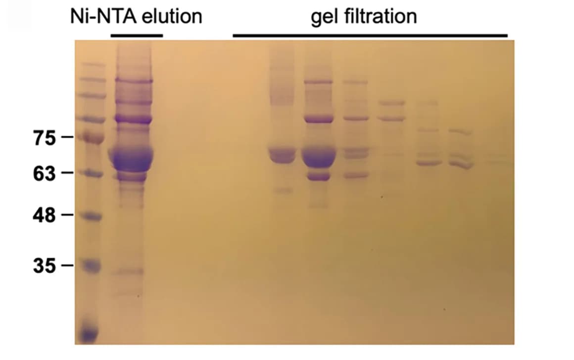 Open access visualization of Gel, Coomassie stain, SDS-PAGE, Purified CHIMERA