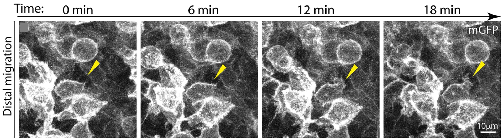 Open access visualization of Microscopy, Neural Crest, Cell Migration, Lamellipodia, Filopodia