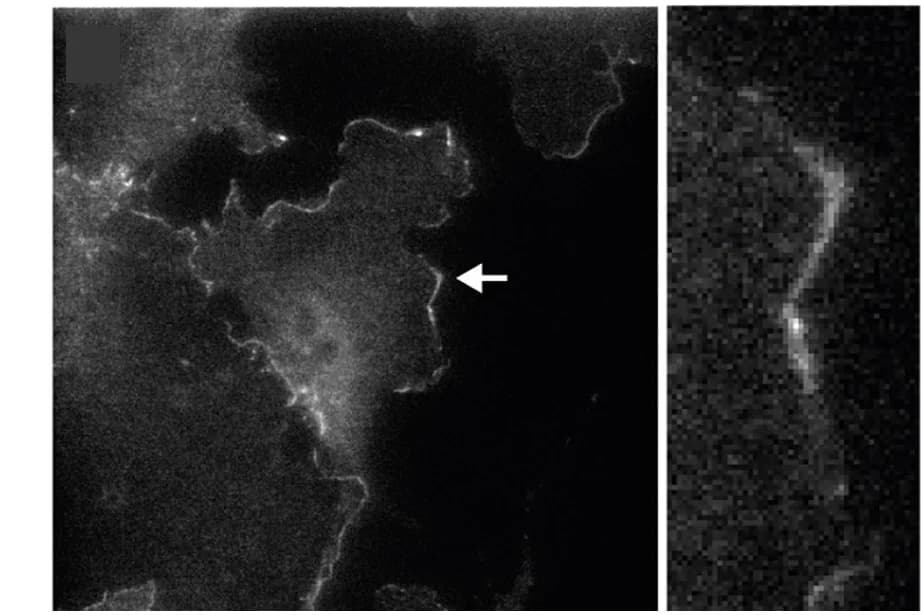 Open access visualization of Microscopy, Abi1 Immunostaining, Wnt1::cre;Lpd+/+;LifeAct-EGFP, Wnt1::cre;Lpd+/fl;LifeAct-EGFP, Wnt1::cre;Lpdfl/fl;LifeAct-EGFP