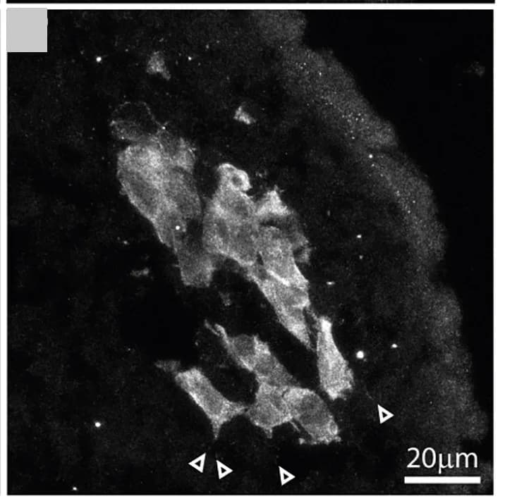 Open access visualization of Microscopy, Maximum-intensity Projections, E8.75, Wnt1::cre;Lpd+/+;Rosa26MTMG Embryos, Pharyngeal Arch 1