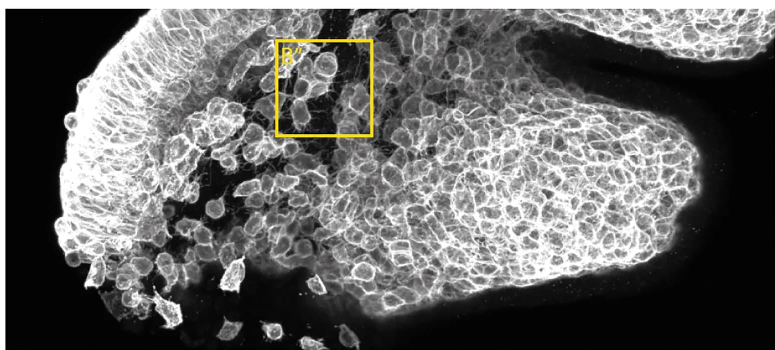 Open access visualization of Microscopy, Maximum-intensity Projections, E8.75, Wnt1::cre;Lpd+/fl;Rosa26MTMG Embryos, Pharyngeal Arch 1
