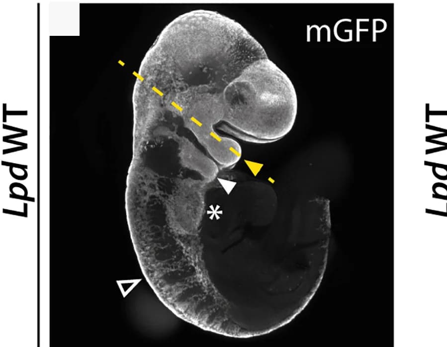 Open access visualization of Microscopy, Maximum-intensity Projection, Wnt1::cre;Lpd+/+;Rosa26MTMG Embryos, E9.5 Embryos, Pharyngeal Arch 1
