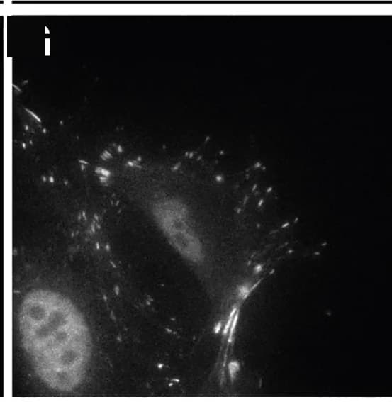 Open access visualization of Microscopy, Vinculin, Immunostaining, Embryos, LifeAct-EGFP