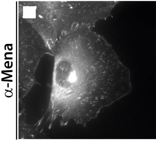 Open access visualization of Microscopy, Lpd, Mena, Co-immunostaining, DMSO