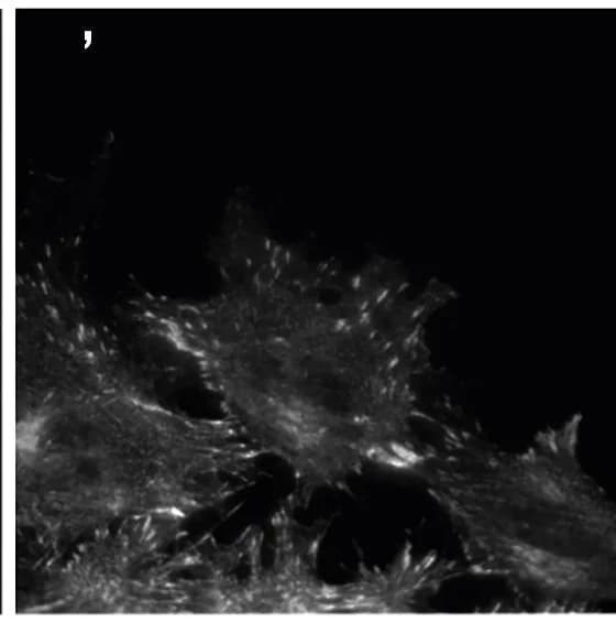 Open access visualization of Microscopy, Lpd, Mena, Co-immunostaining, GSK3 inhibitor