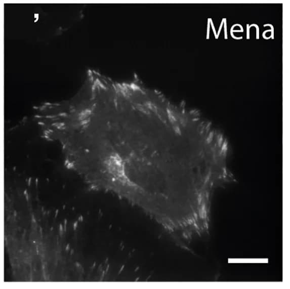 Open access visualization of Microscopy, Lpd, Mena, Co-immunostaining, GSK3 inhibitor