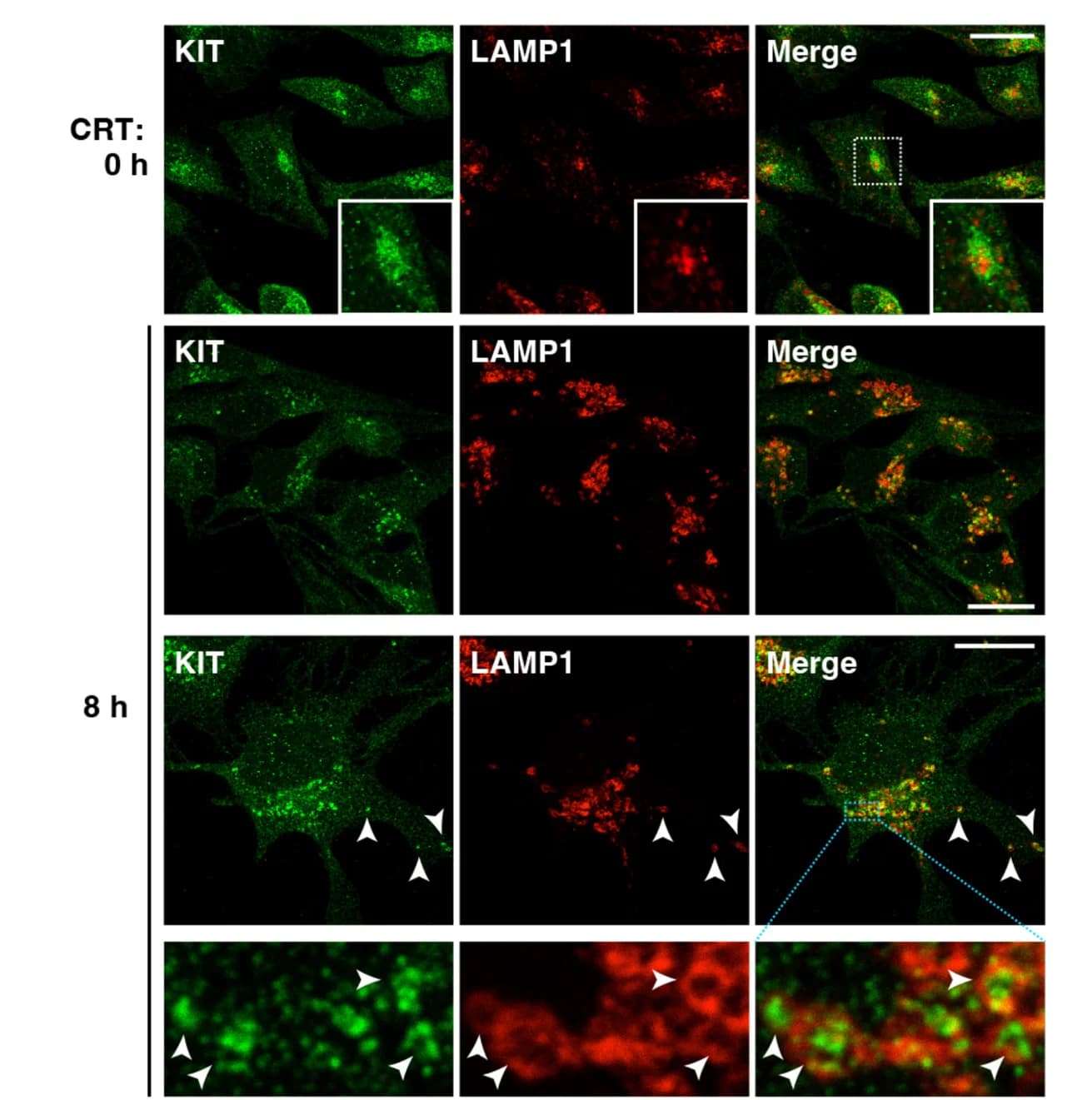 Open access visualization of Microscopy, KIT, LAMP1, Immunostaining, Lysosomes