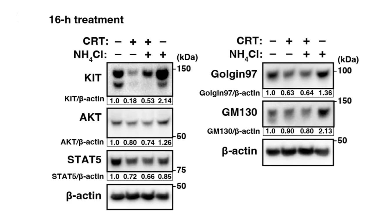 Open access visualization of Gel, GIST-T1 Cells, CRT, NH4Cl, Immunoblotting