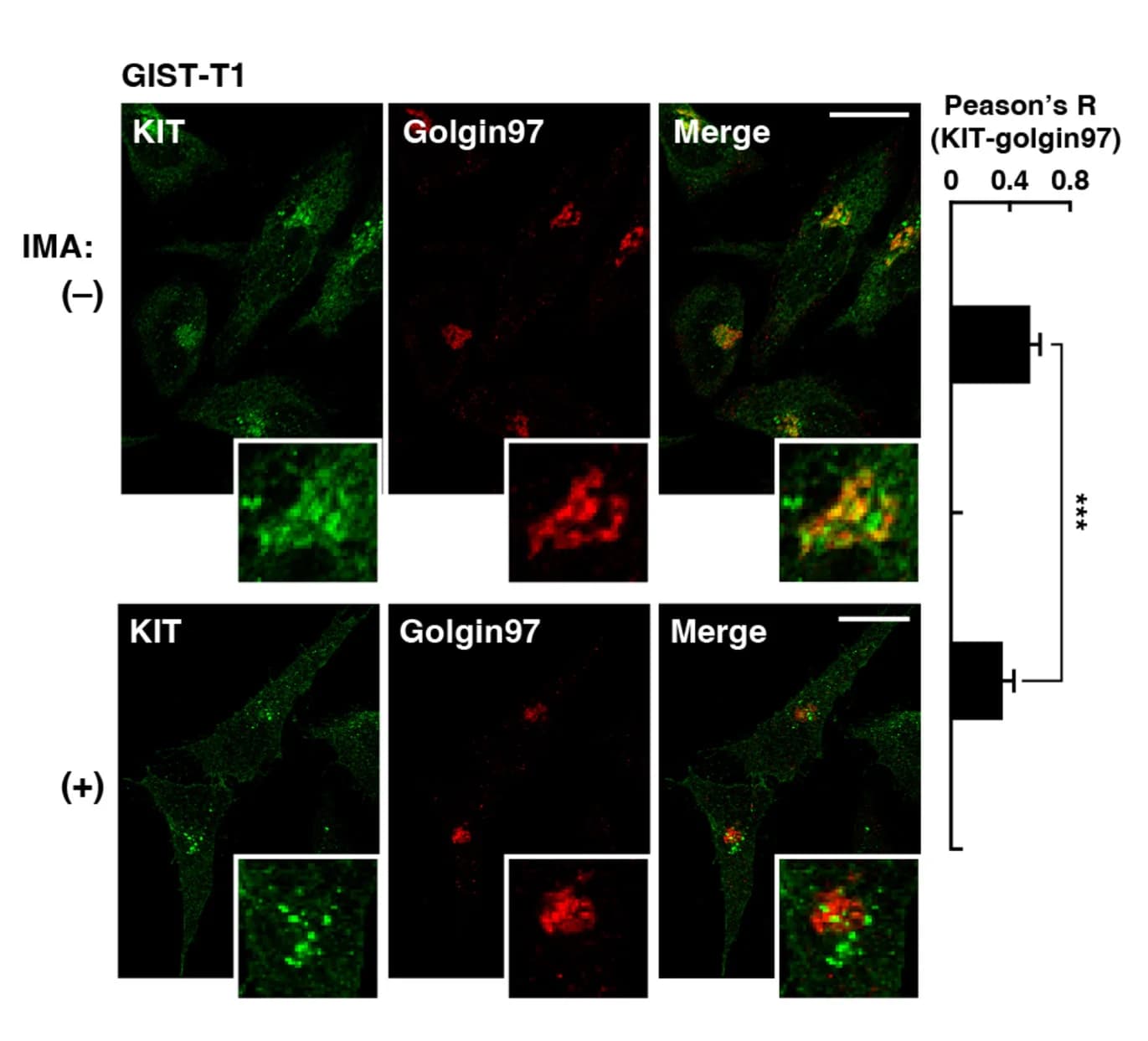 Open access visualization of Microscopy, Bar Plot, Error Bars, GIST-T1 Cells, Imatinib