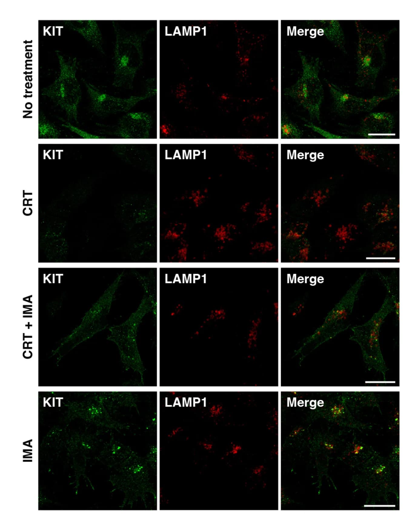 Open access visualization of Microscopy, GIST-T1 Cells, CRT0066101, CRT, Imatinib