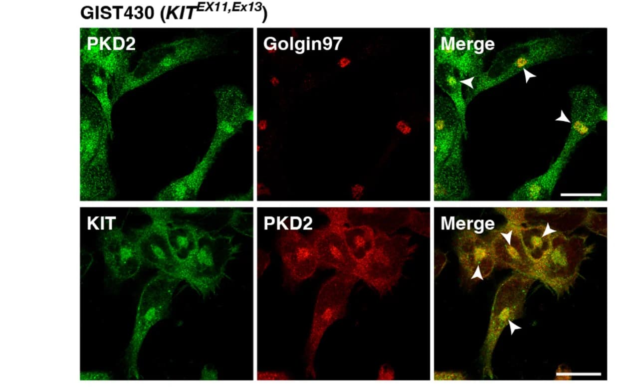 Open access visualization of Microscopy, Immunostaining, GIST-T1 Cells, GIST430 Cells