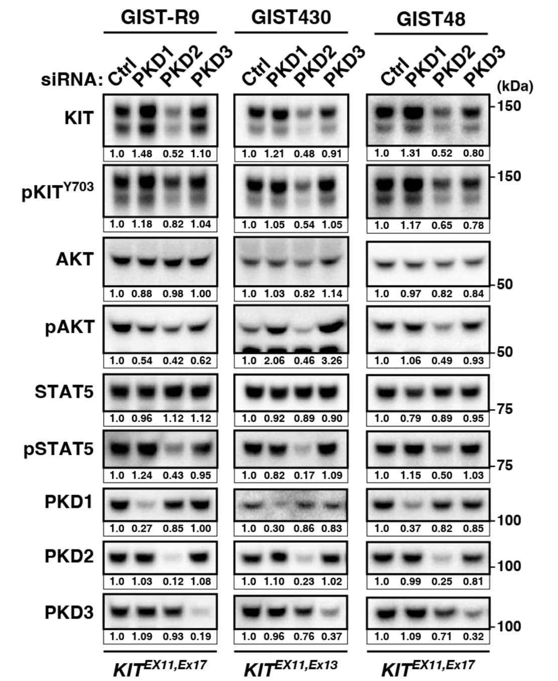 Open access visualization of Gel, Transfection, siRNAs, Immunoblotting, GIST Cells