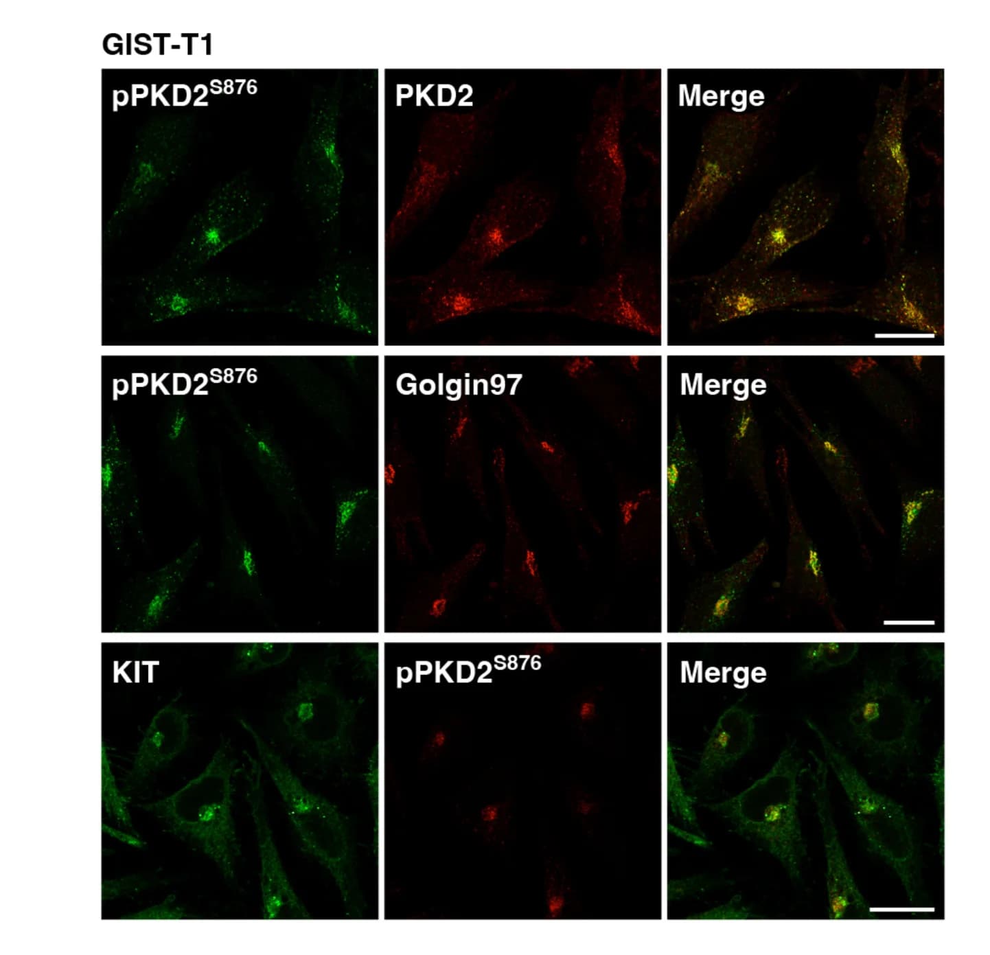 Open access visualization of Microscopy, GIST-T1 Cells, Immunostaining, pPKD2S876, PKD2