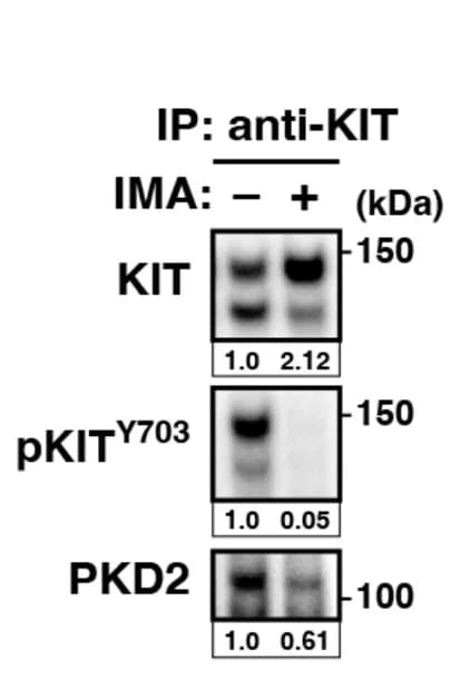 Open access visualization of Gel, GIST-T1 Cells, IMA, KIT, Immunoprecipitation