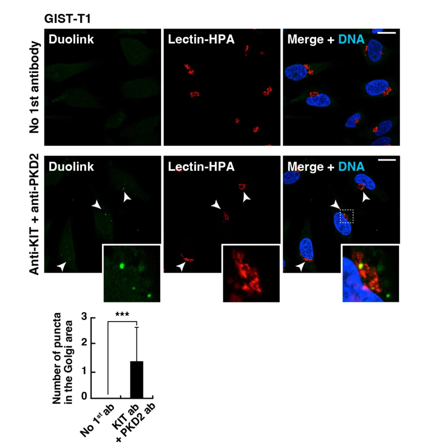 Open access visualization of Microscopy, Bar Plot, Proximity Ligation Assay, KIT, PKD2