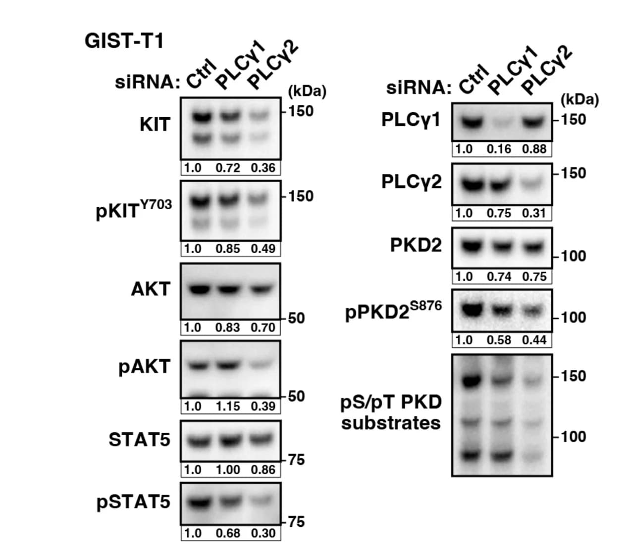 Open access visualization of Gel, GIST-T1 Cells, siRNAs, Lysates, Immunoblotting