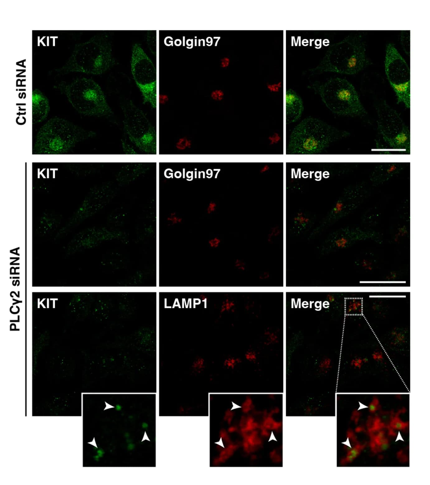 Open access visualization of Microscopy, Cells, Immunostaining, KIT, golgin97