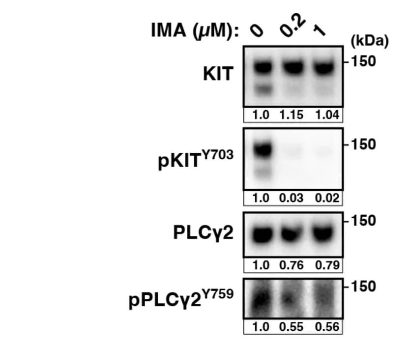 Open access visualization of Gel, GIST-T1 Cells, IMA, Lysates, Immunoblotting