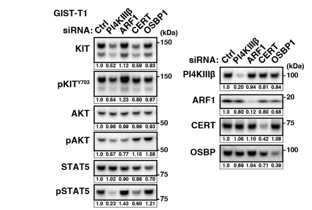 Open access visualization of Gel, GIST-T1 Cells, siRNAs, Immunoblotting, Lysates