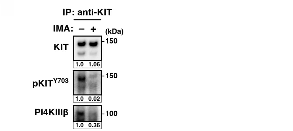 Open access visualization of Gel, GIST-T1 Cells, IMA, KIT, Immunoprecipitation