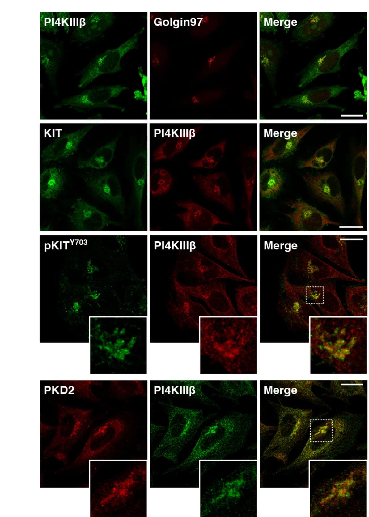 Open access visualization of Microscopy, GIST-T1 Cells, Immunostaining, Antibodies