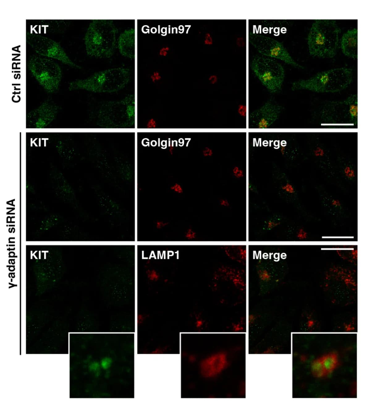 Open access visualization of Microscopy, Cells, Immunostaining, KIT, Golgin97