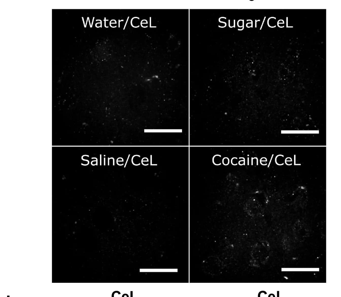 Open access visualization of Microscopy, Brain Slices, CeL, GluN2B Subunits, NMDARs