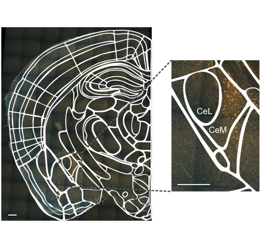 Open access visualization of Microscopy, Brain Slice, mCherry, DREADD Virus, CeM