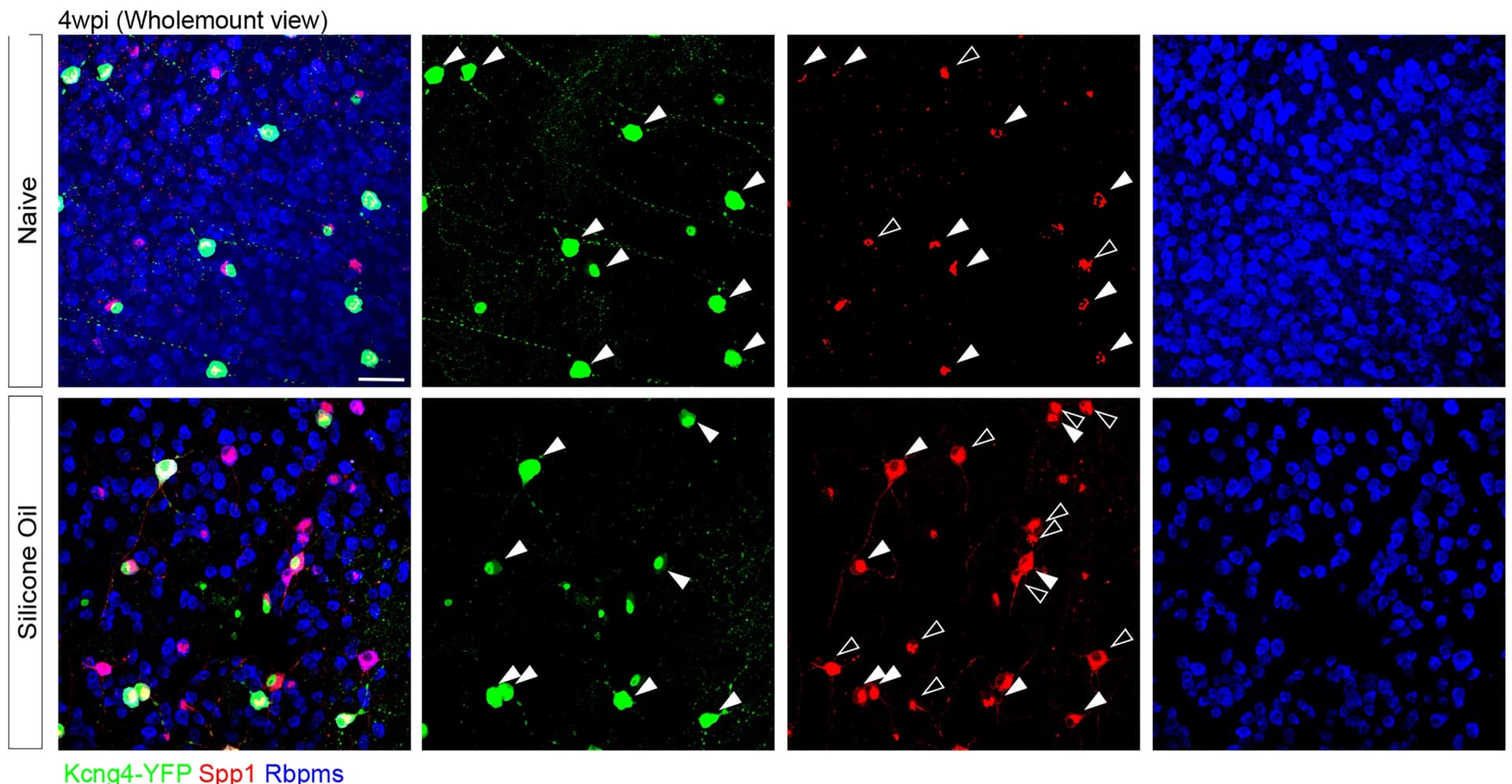 Open access visualization of Microscopy, Retinal whole-mount images, Kcng4-YFP, YFP, Spp1