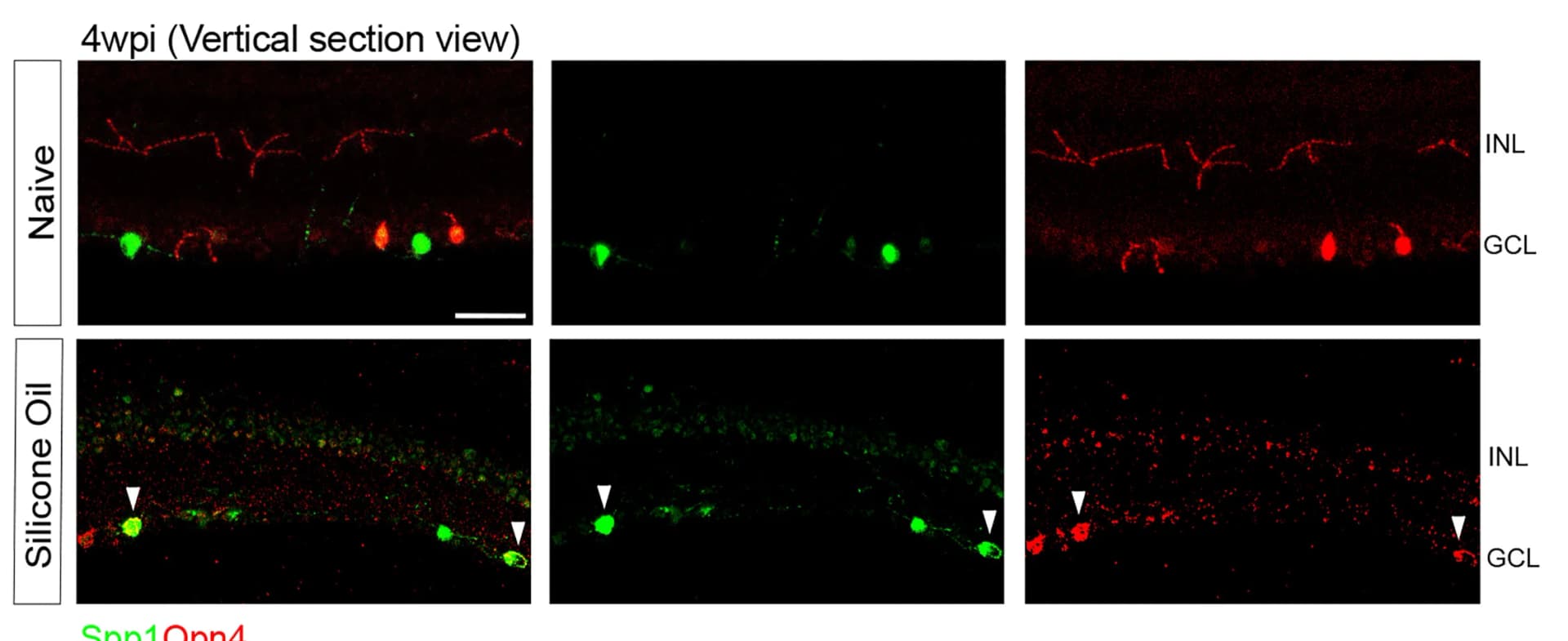 Open access visualization of Microscopy, Vertical section, Retina, Spp1, Opn4