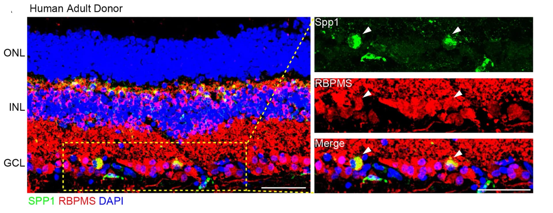 Open access visualization of Microscopy, SPP1, RBPMS, Retina, RGC