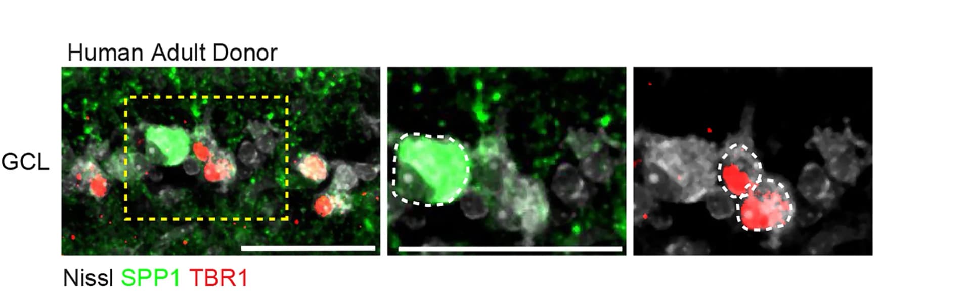 Open access visualization of Microscopy, SPP1, TBR1, Nissl, Retina