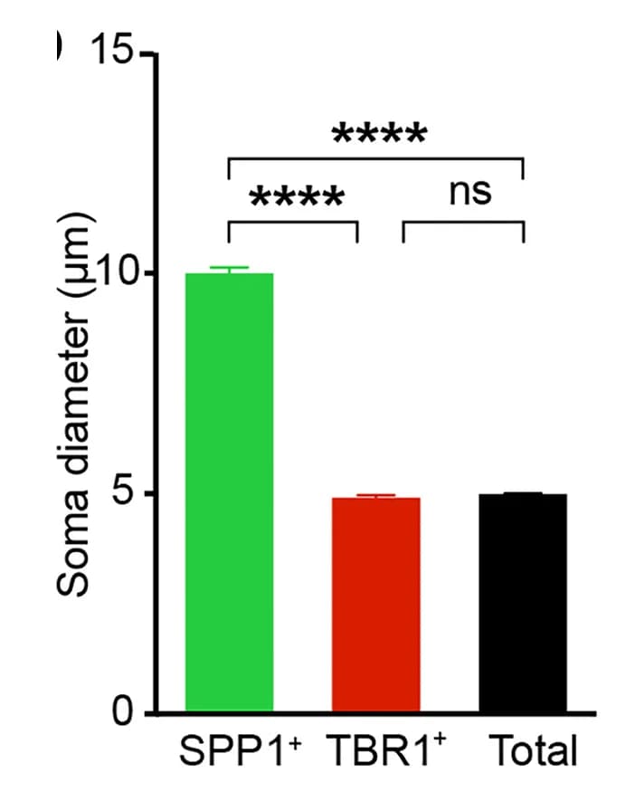 Open access visualization of Bar Plot, Error Bars, RGC, Soma Size, SPP1