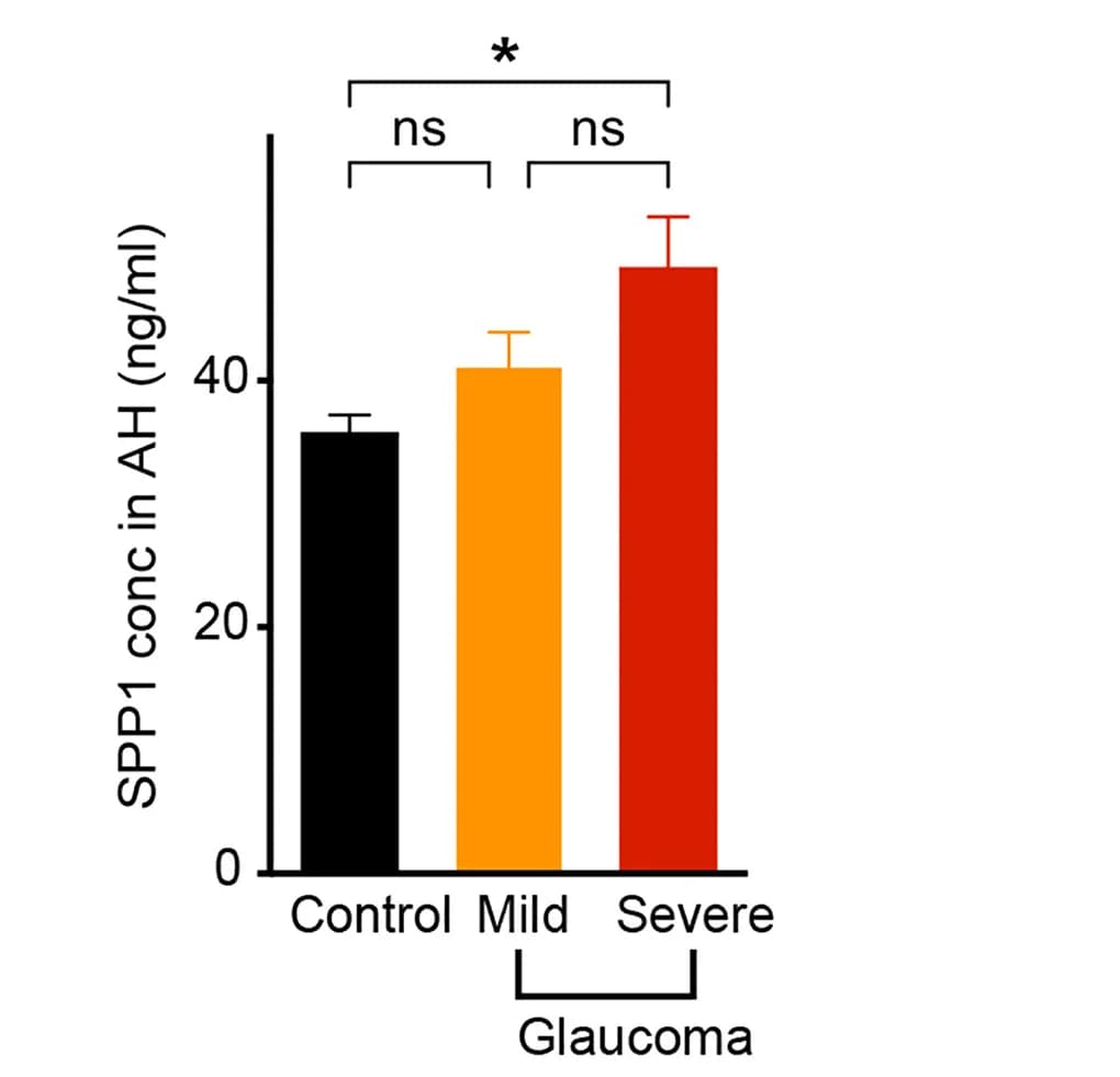 Open access visualization of Bar Plot, Error Bars, SPP1, Aqueous Humor, ELISA