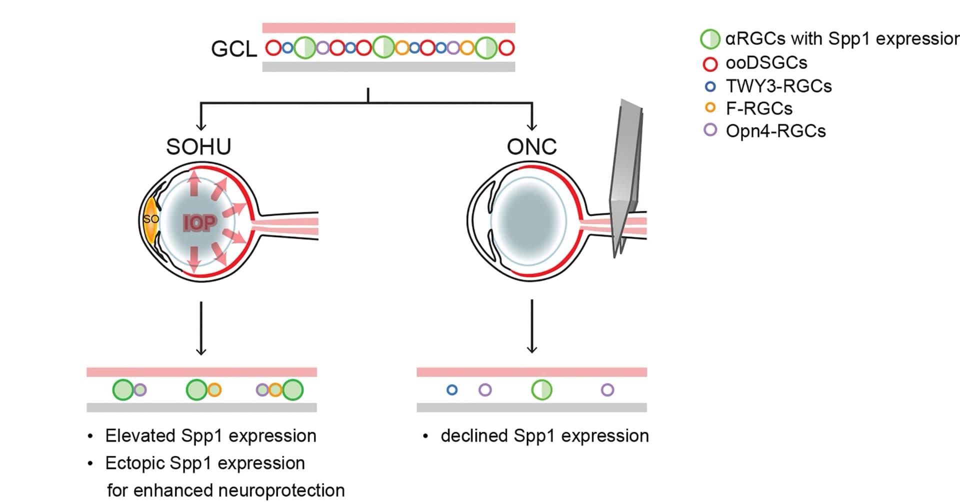 Open access visualization of Illustration, Workflow, Spp1, RGC, SOHU