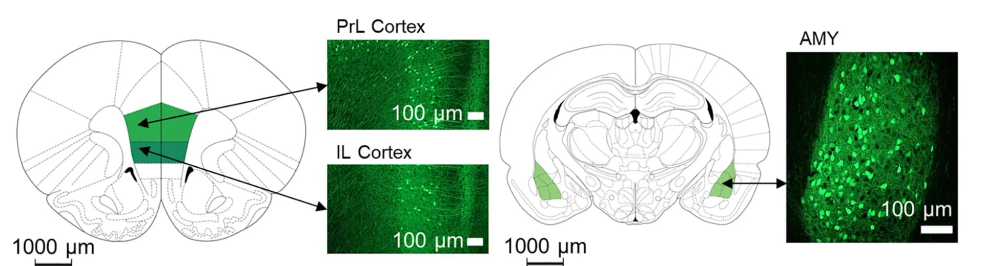 Open access visualization of Microscopy, Illustration, Brain Atlas Sections, Mouse Model, Pyramidal Neurons