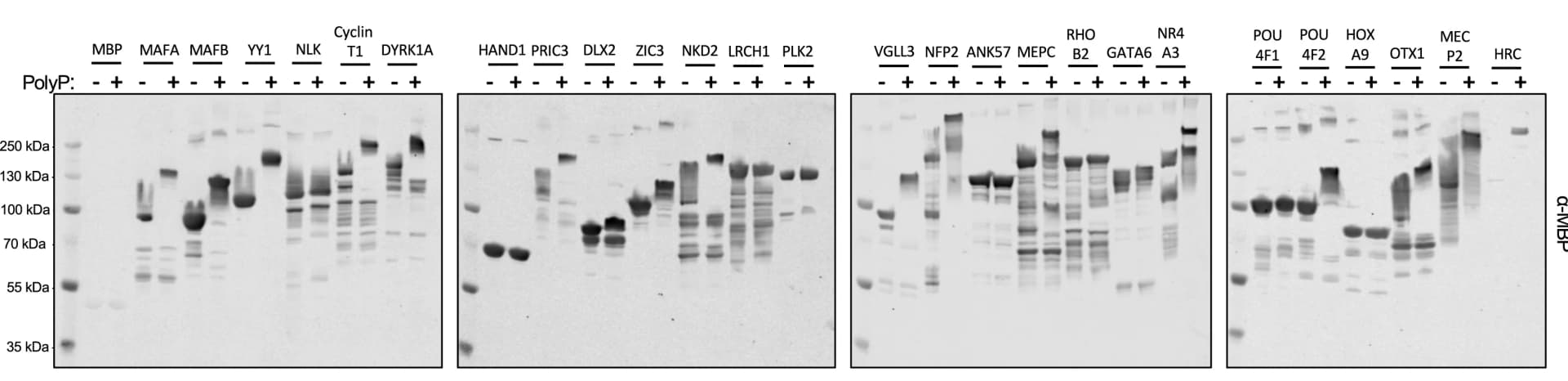 Open access visualization of Gel, NuPAGE, Histidine Repeat, Protein Analysis