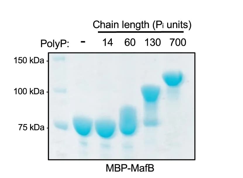 Open access visualization of Gel, NuPAGE, Polyphosphate, Chain Length