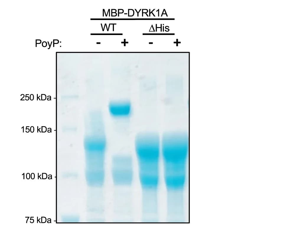 Open access visualization of Gel, Histidine Repeat, DYRK1A, MafB, MBP
