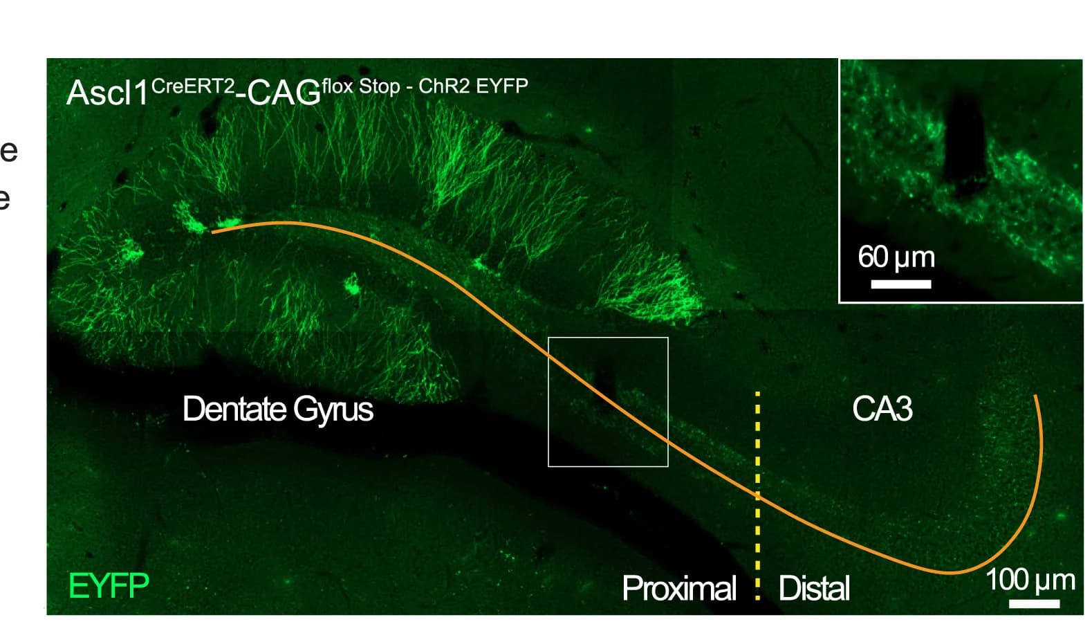 Open access visualization of Microscopy, Histology, aGCs, EYFP, Proximodistal Axis