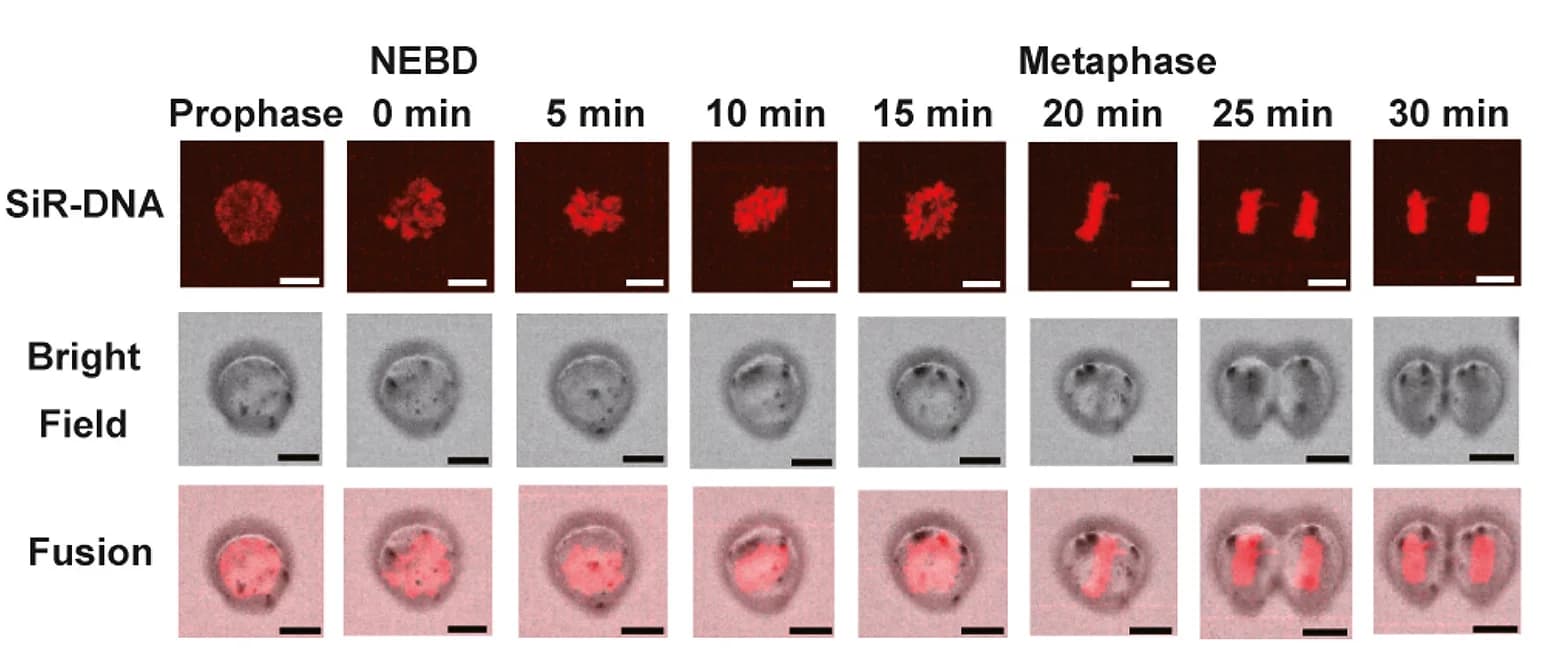 Open access visualization of Microscopy, Photo, Time-Lapse Imaging, MDS, Cells