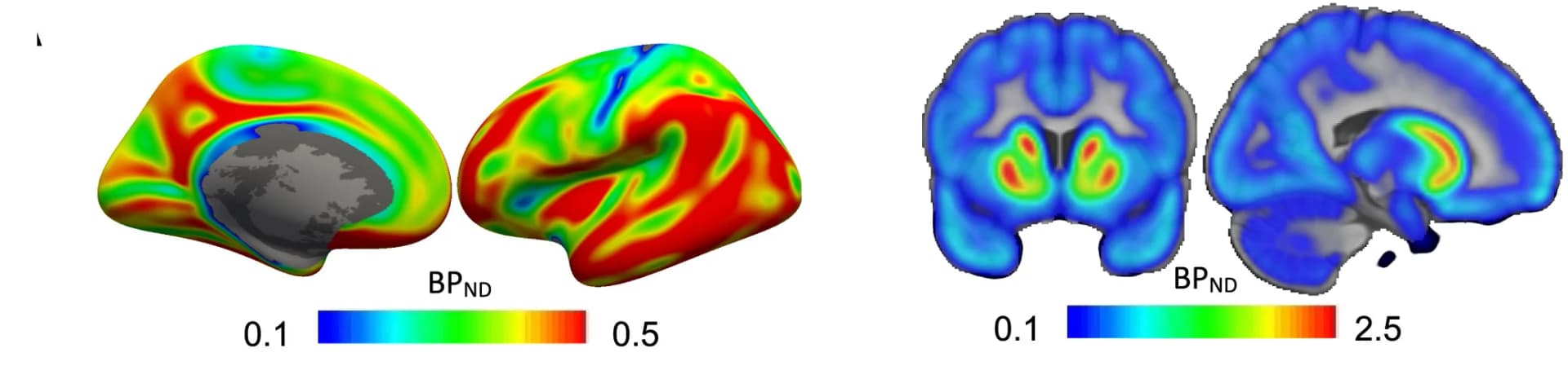 Open access visualization of 3D Plot, Cortex, Deep Brain Structures, Spatial Distribution, D1DRs