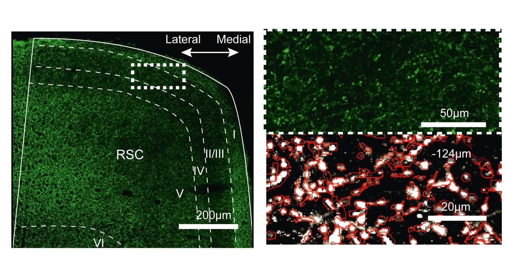 Open access visualization of Microscopy, Confocal Image, Brain Slice, GCaMP6s, M2 Axons