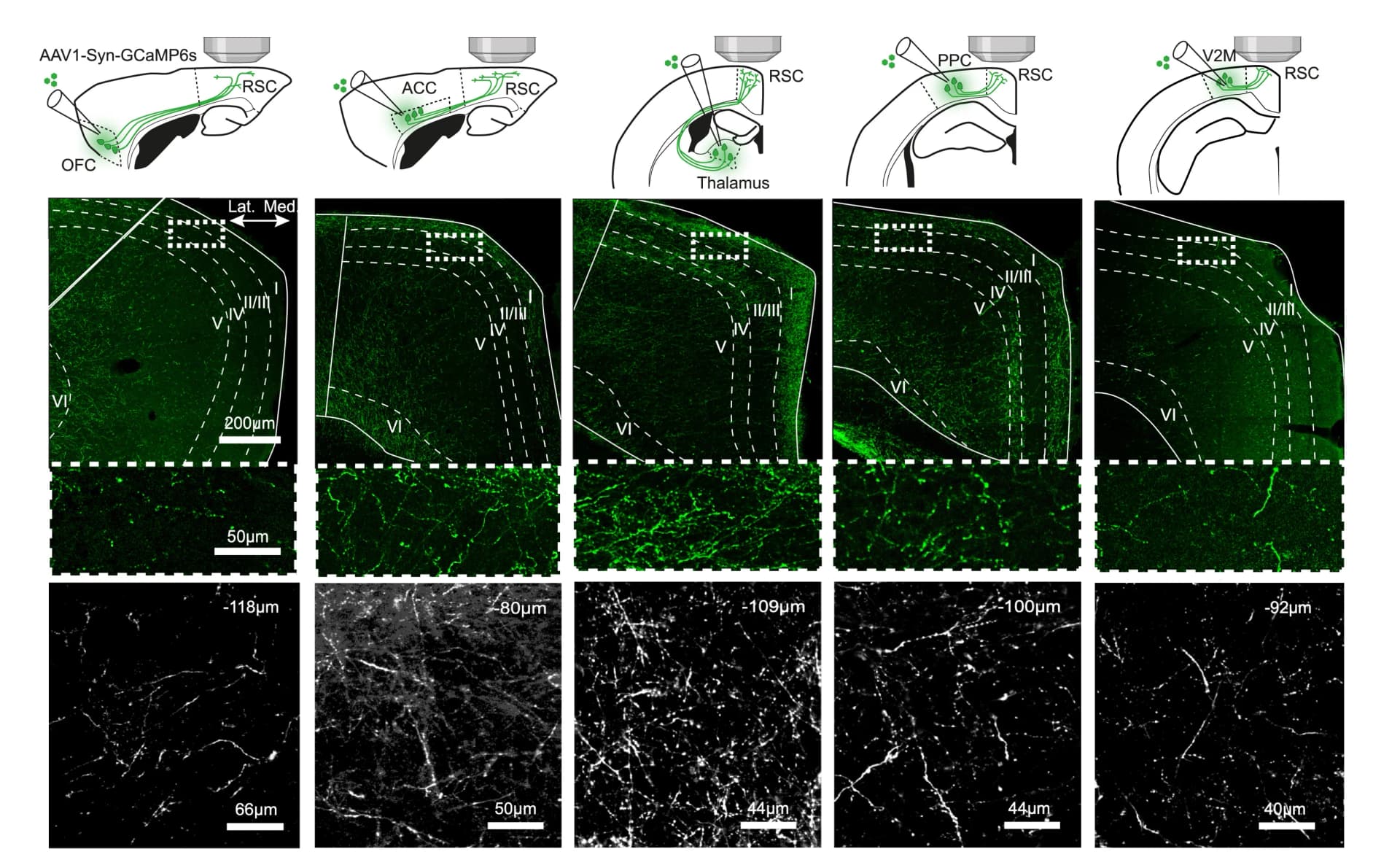 Open access visualization of Microscopy, Illustration, GCaMP6s construct, Axons, Confocal fluorescence images